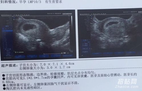 香港驗血測儀器(香港裕博生物科技有限公司驗血準(zhǔn)確嗎) 