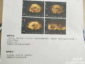 香港驗血結(jié)果16項n(香港驗血查dna結(jié)果單子怎么看 ) 