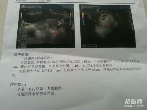香港驗(yàn)血要再次查血(有懂的辣媽進(jìn)來說說,香港驗(yàn)血什么情況