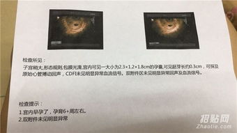 香港驗血ve多是什么意思(驗血報告里ve是什么意思) 