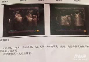 香港驗(yàn)血查男女被騙了(央視香港驗(yàn)性別騙局,香港驗(yàn)血是不是
