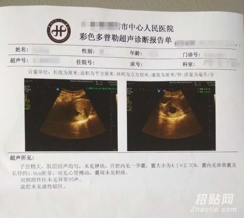 有人去香港驗血查男女(有去香港驗血是女孩生下來是男孩的)