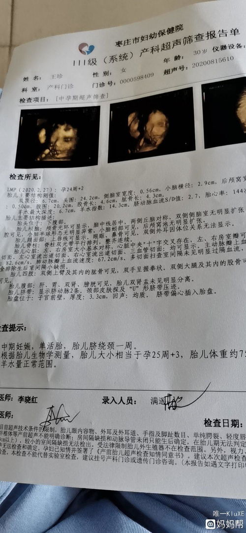 香港男寶女寶驗血區(qū)別在哪(驗血生男生女準(zhǔn)確率) 