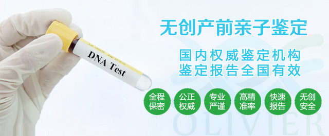 精確的檢測驗血規(guī)范寄檢服務(wù)