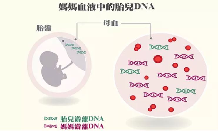 唐氏篩檢查男女辦法準(zhǔn)嗎?